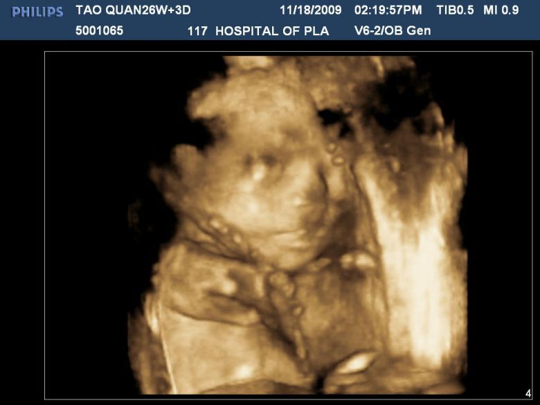 117医院三维归来(18号),过程及成果,欢迎大家猜