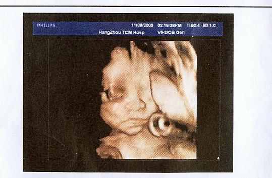晒晒我的孕妇照,还有27周做的三维B超-准妈妈