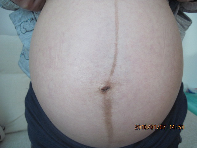 孕31周的大肚照 VS 37周-准妈妈论坛-杭州19楼