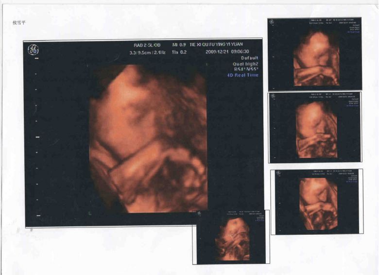 怀孕刚好5个月(22周+3天),看看我的大肚照,JM