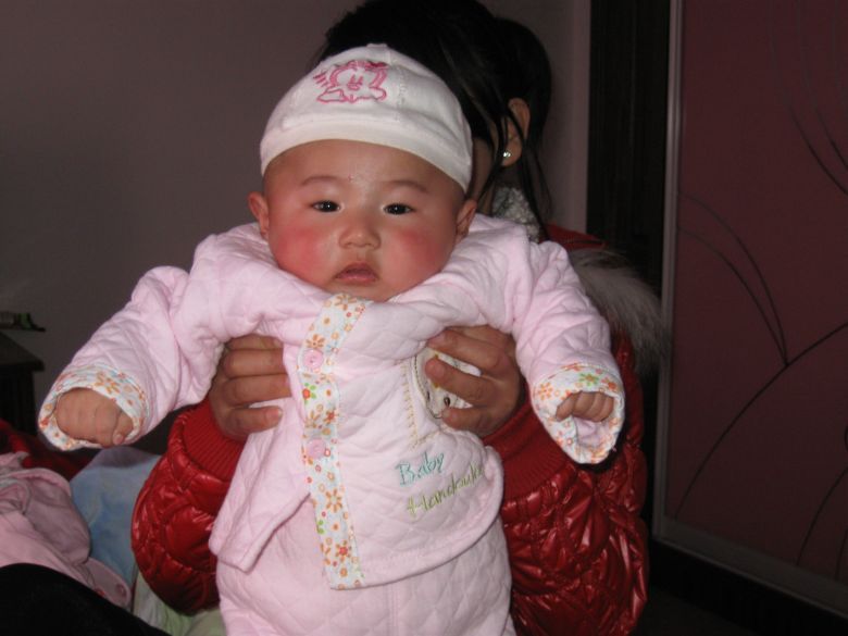 我家宝宝的斜颈终于好了-孩爸孩妈聊天室-杭州