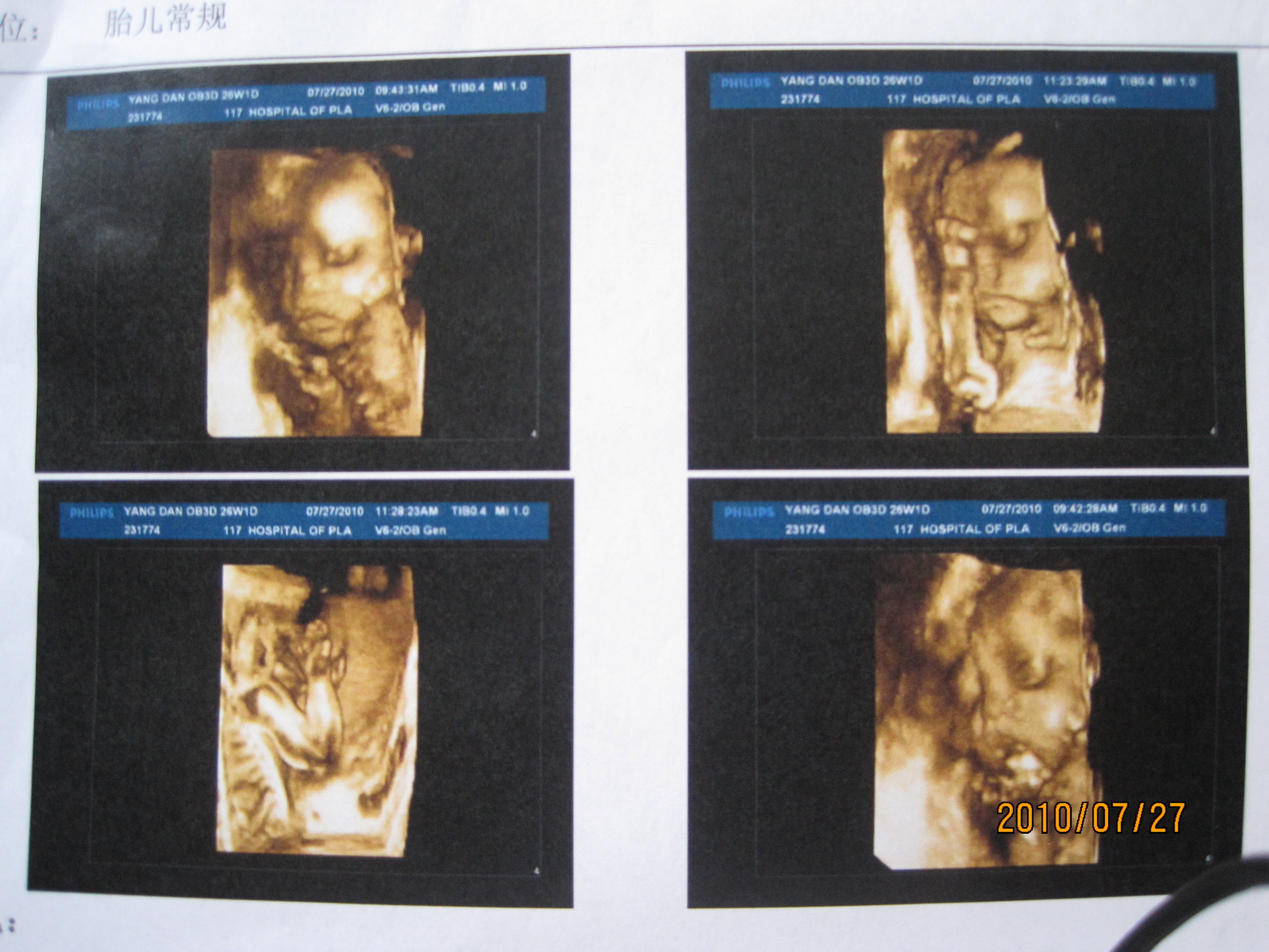 117医院三维b超回来