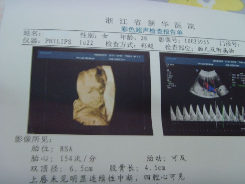 宝宝在新华医院做三维B超-准妈妈论坛-杭州19