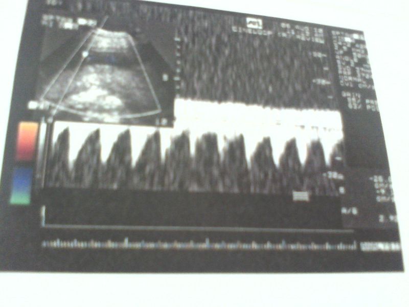 老觉得口渴啊 怎么办-准妈妈论坛-杭州19楼