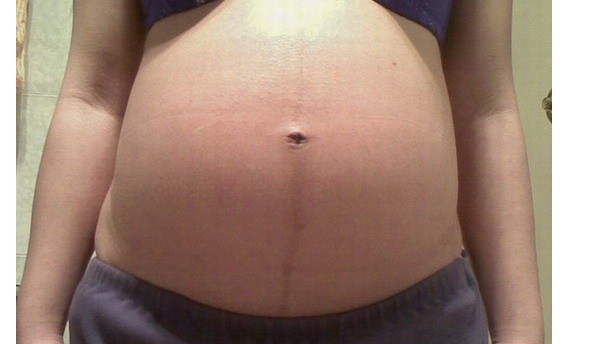 怀孕妈妈们肚子上那条黑线是什么? 妊娠线是怎么形成的 20100828 c60ac0db37f39ccbd8adkJseRHAterse - 怀孕妈妈们肚子上那条黑线是什么? 妊娠线是怎么形成的