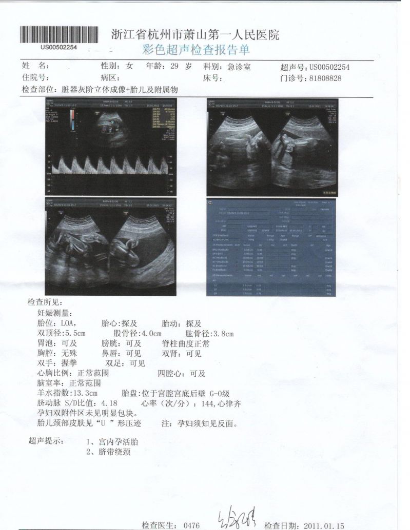 三维B超,有图片,大家来猜男女-准妈妈论坛-杭州
