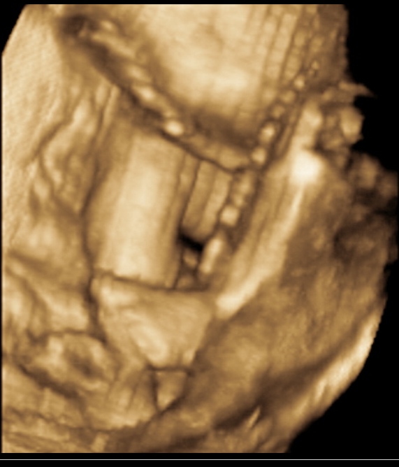 117三维彩超归来,请围观,哈!-准妈妈论坛-杭州