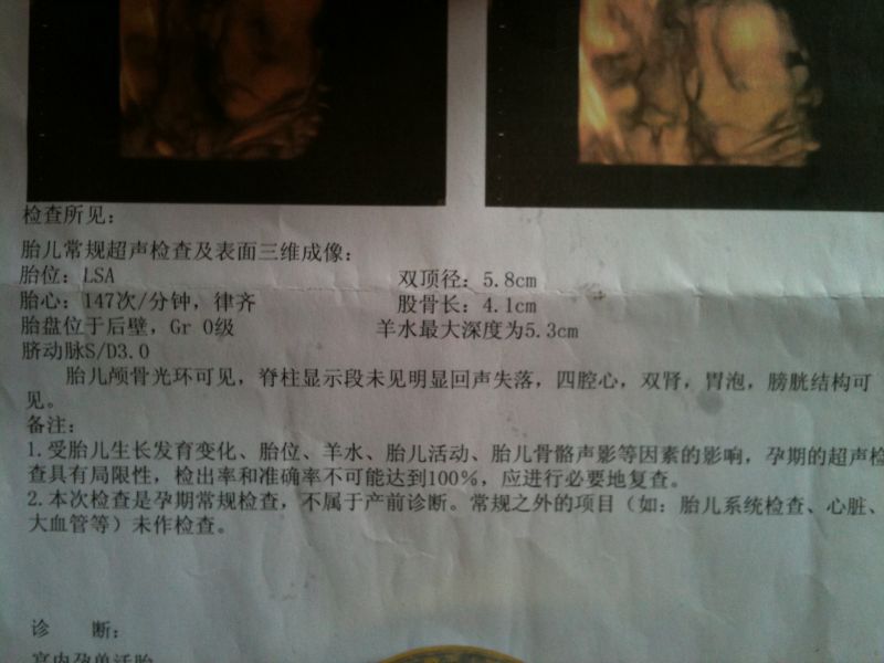 【★三维B超归来★ 有DDP照,帮忙看数据猜男