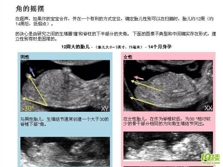 14周B超最能看出宝宝的性别-准妈妈论坛-杭州