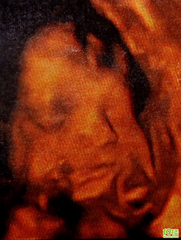 妇保三维彩超25周3天,大家来猜下男女-准妈妈