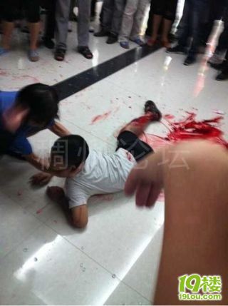 义乌新造不久的篁园服装市场玻璃掉下来砸到小