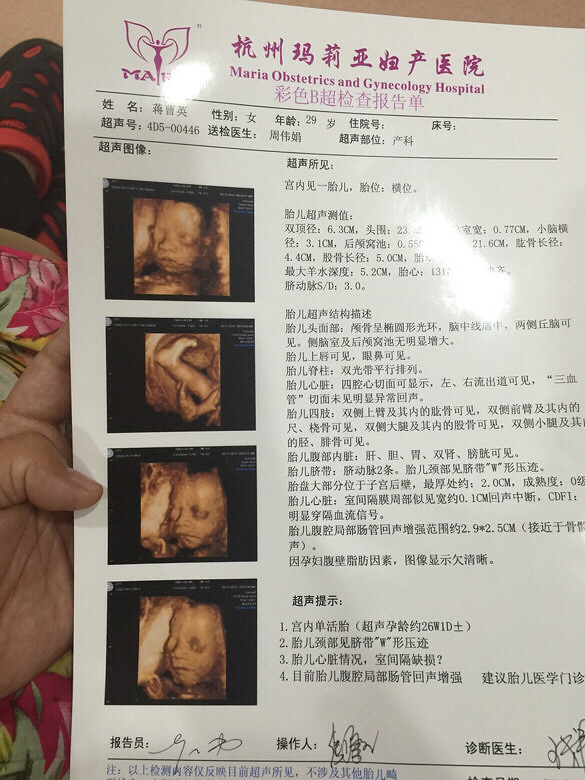 玛丽亚医院也拍出来说胎儿心脏室间隔缺损一-
