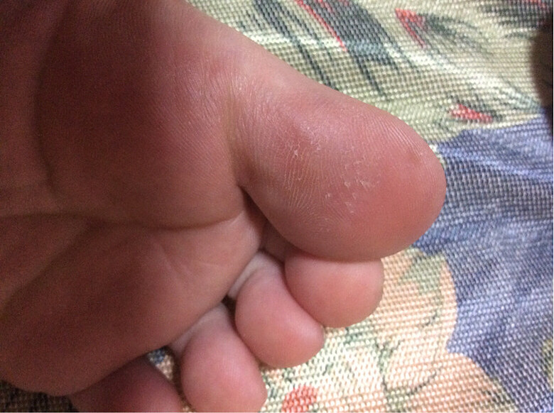 ����  ��32�ܽŵ׸ɣ���Ƥ