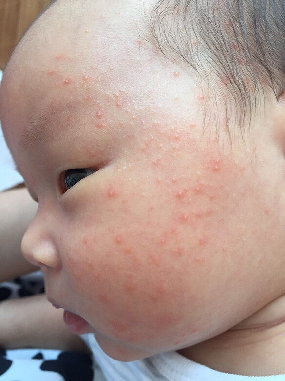 ���� ����ǲ���ʪ�