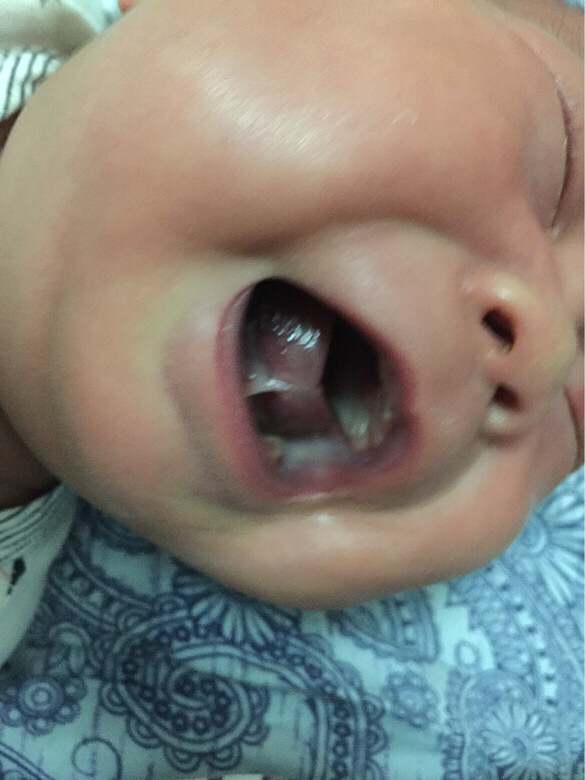 59��Ӥ����ǻ���а�ɫ