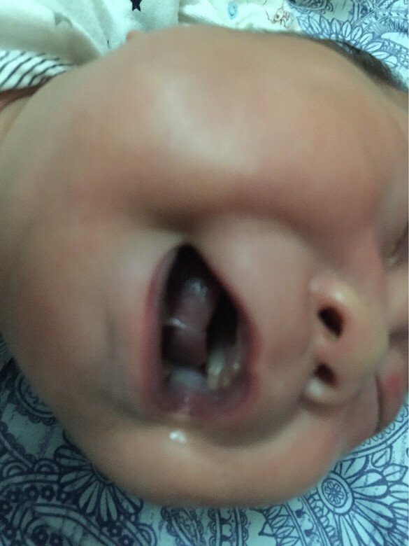 59��Ӥ����ǻ���а�ɫ