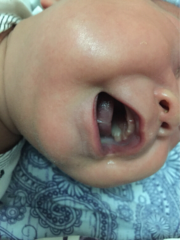 ������Ӥ������ÿ�ο��֣�����