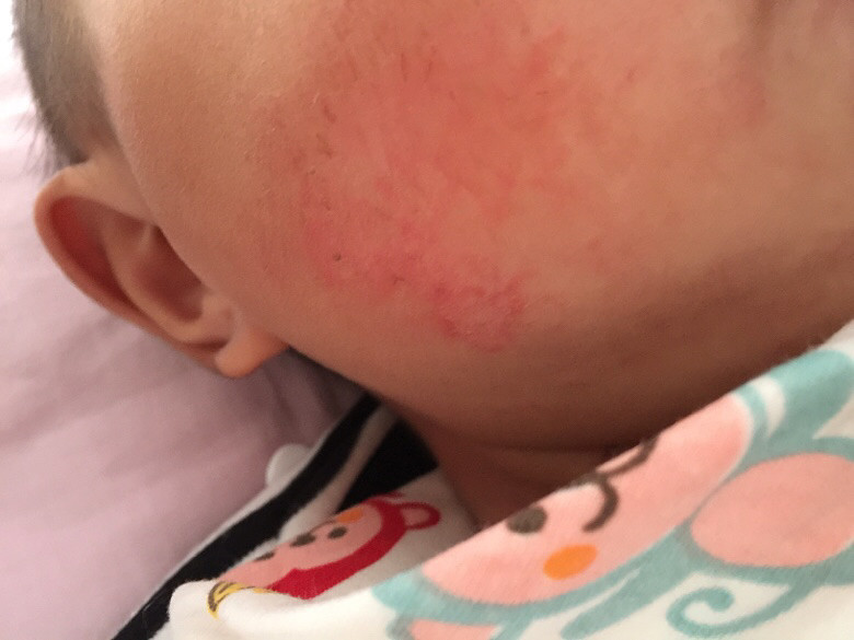 ��ҽ����С���������� �������е���ѿ���