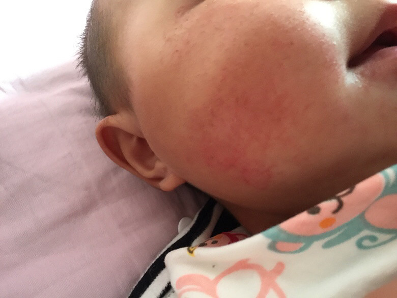 ��ҽ����С���������� �������е���ѿ���