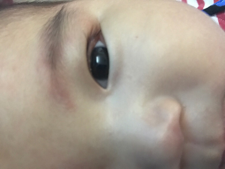 ��������Ƥ���а�ɫ��һ������