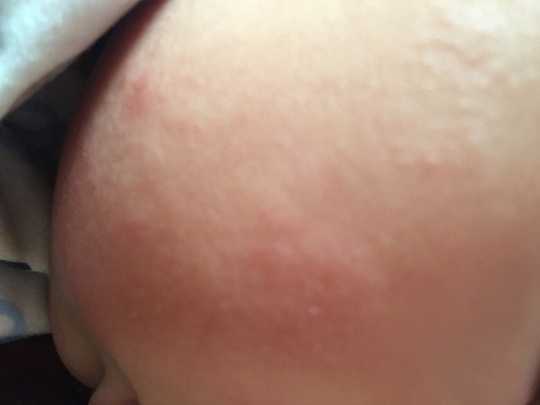 ��á�ҽ�����Ҽұ���8�����¹������ʡ���