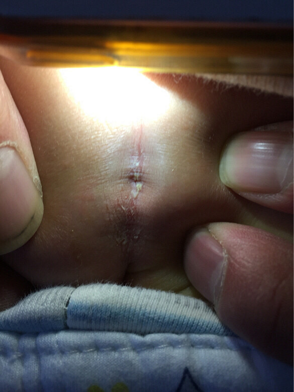 ƨ�ɺ�������