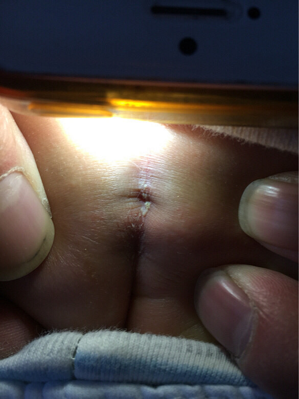 ƨ�ɺ�������