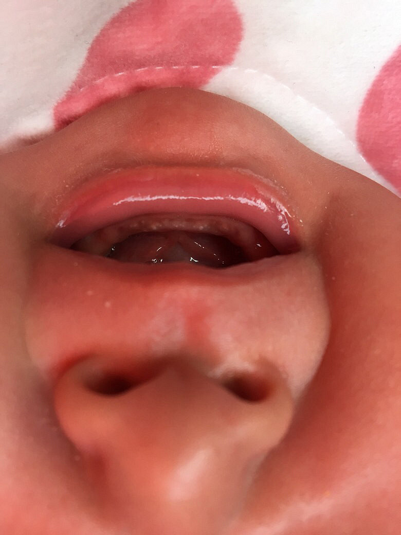 ���������ϳ��˰׵�