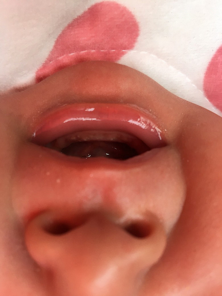 ���������ϳ��˰׵�