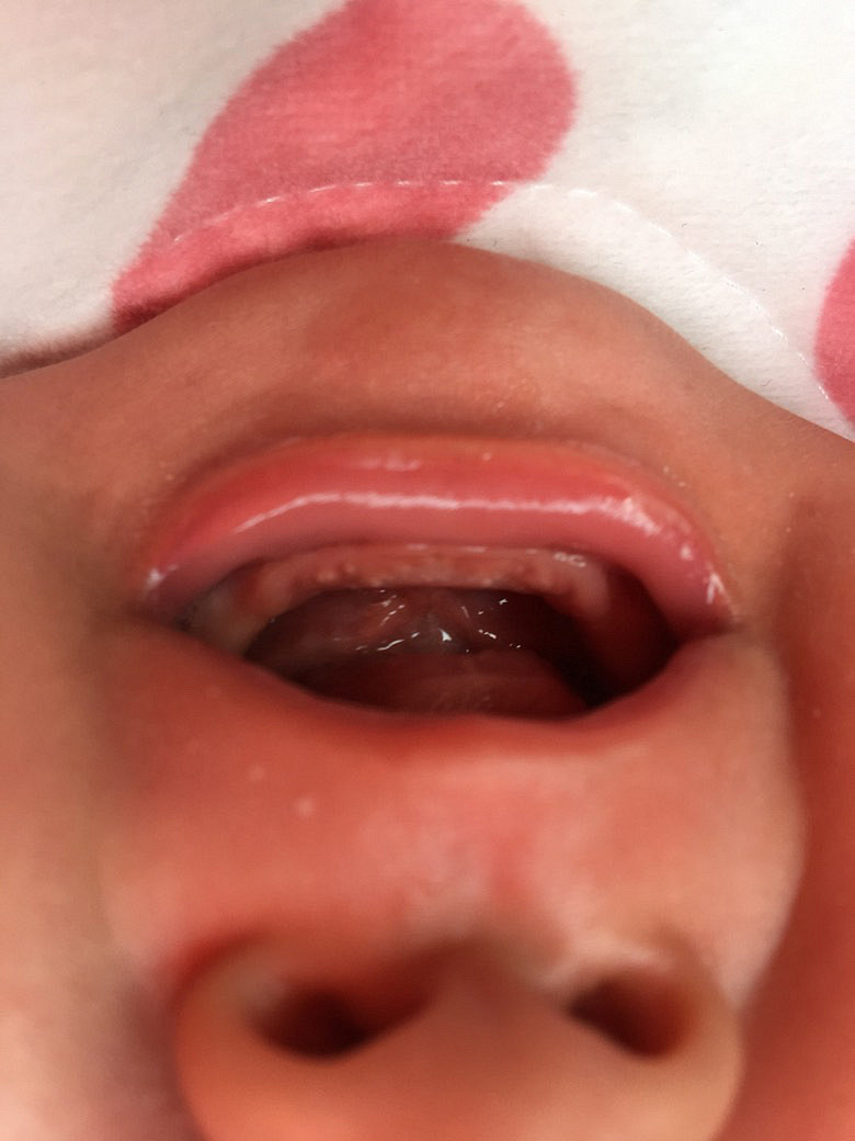 ���������ϳ��˰׵�