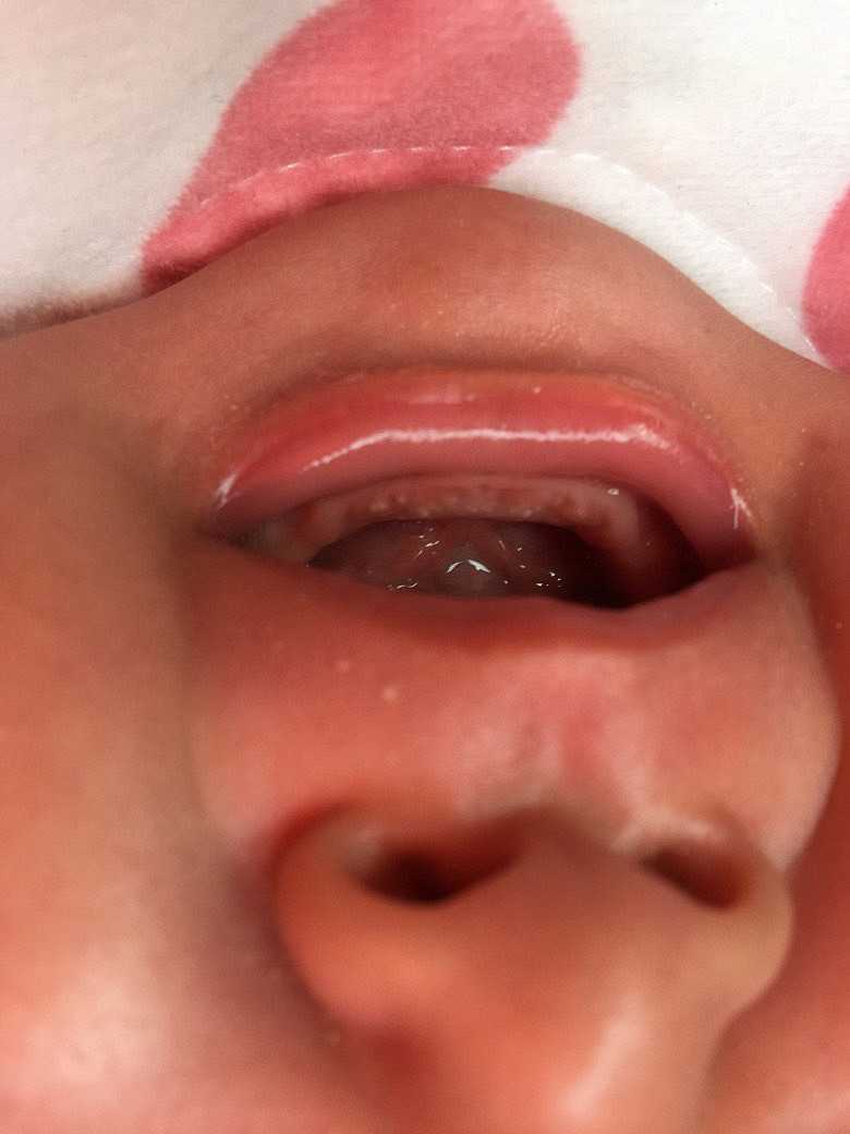 ���������ϳ��˰׵�