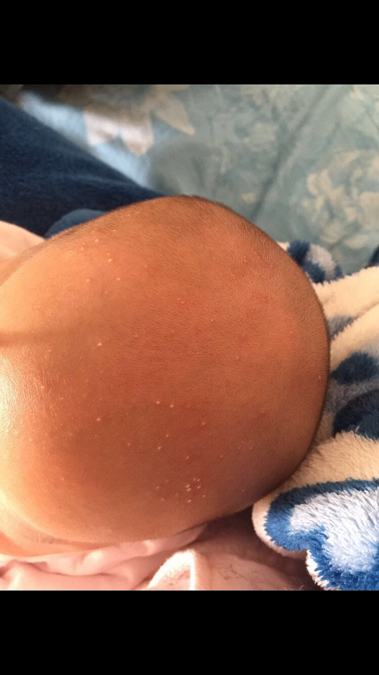 ��ҽ����ã����������£�ͷ�����ǳ���ɶ��