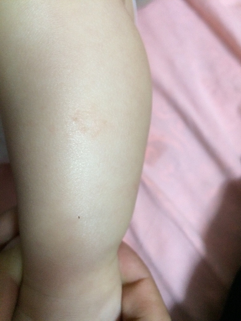 ��ҽ����ã�6�����±���С���ϳ��������