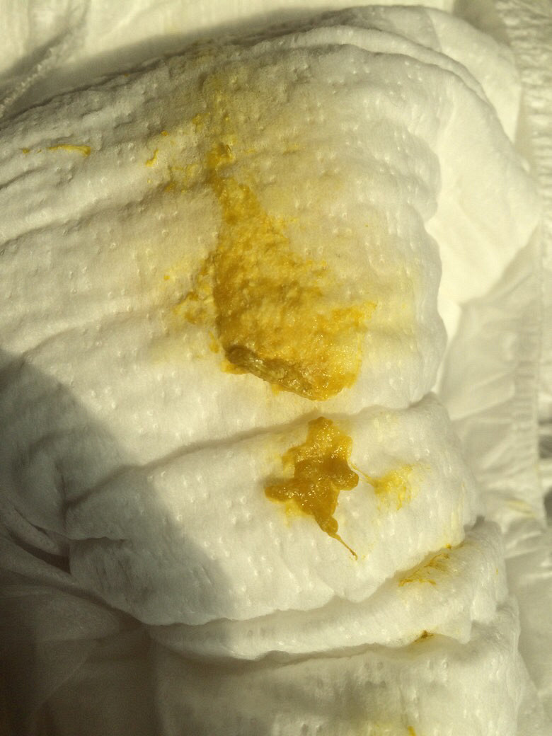 �����ӣ���ͼ���㣩