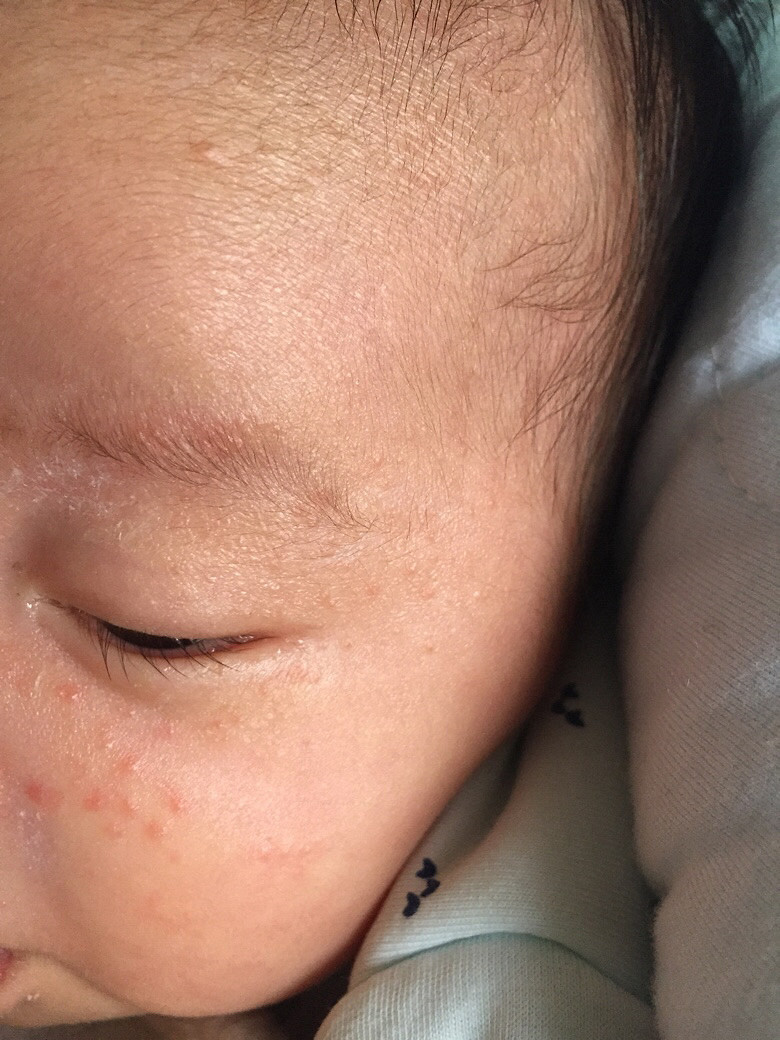 �����ơ�����ҽ����æ���±������ϳ�����ʲô