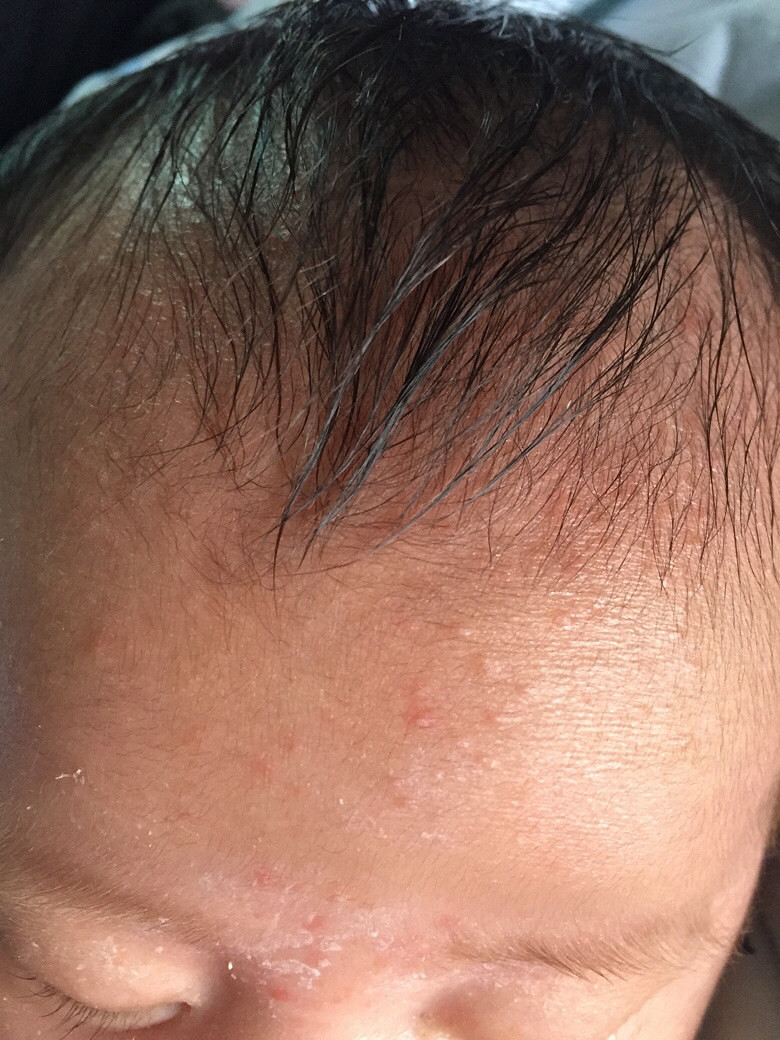 �����ơ�����ҽ����æ���±������ϳ�����ʲô