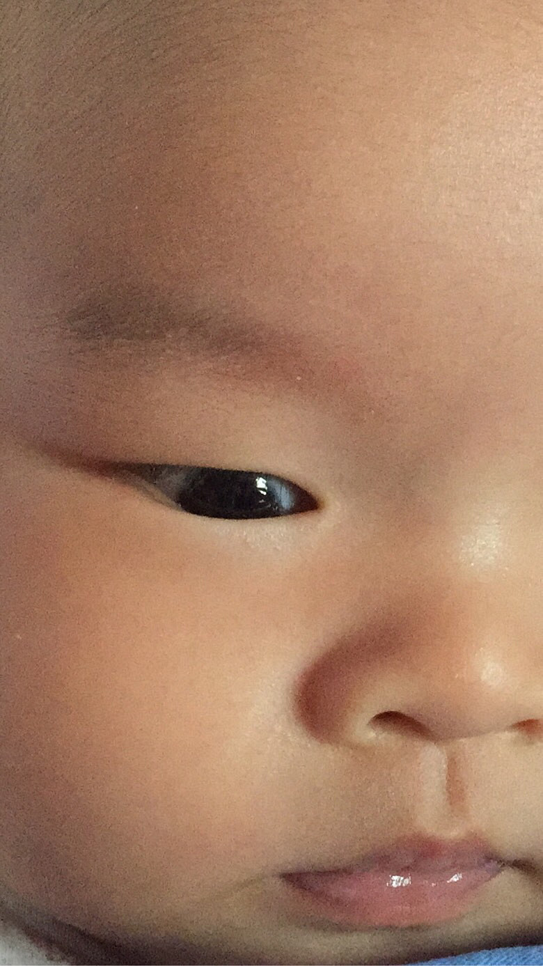 2������Ӥ���۾�������һ��Ĥ