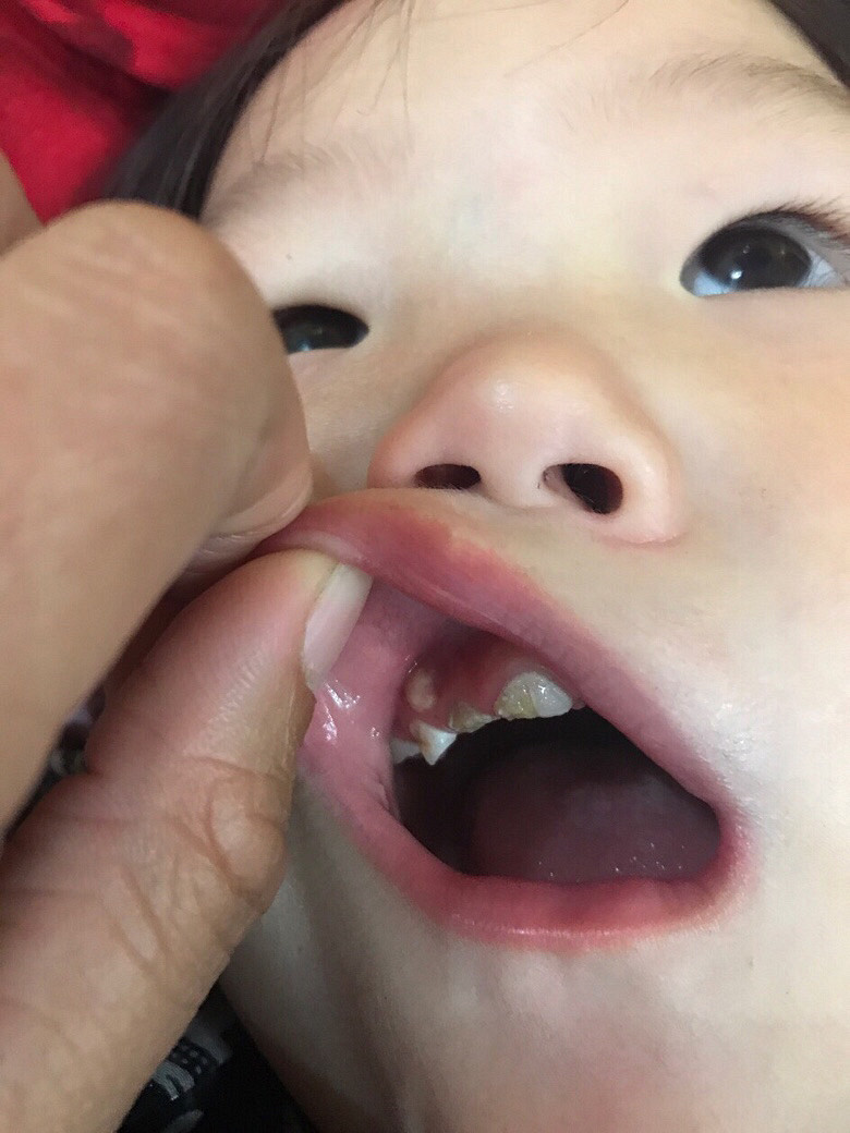 ����ҽ���Ҽұ��������ô���£������ϳ���