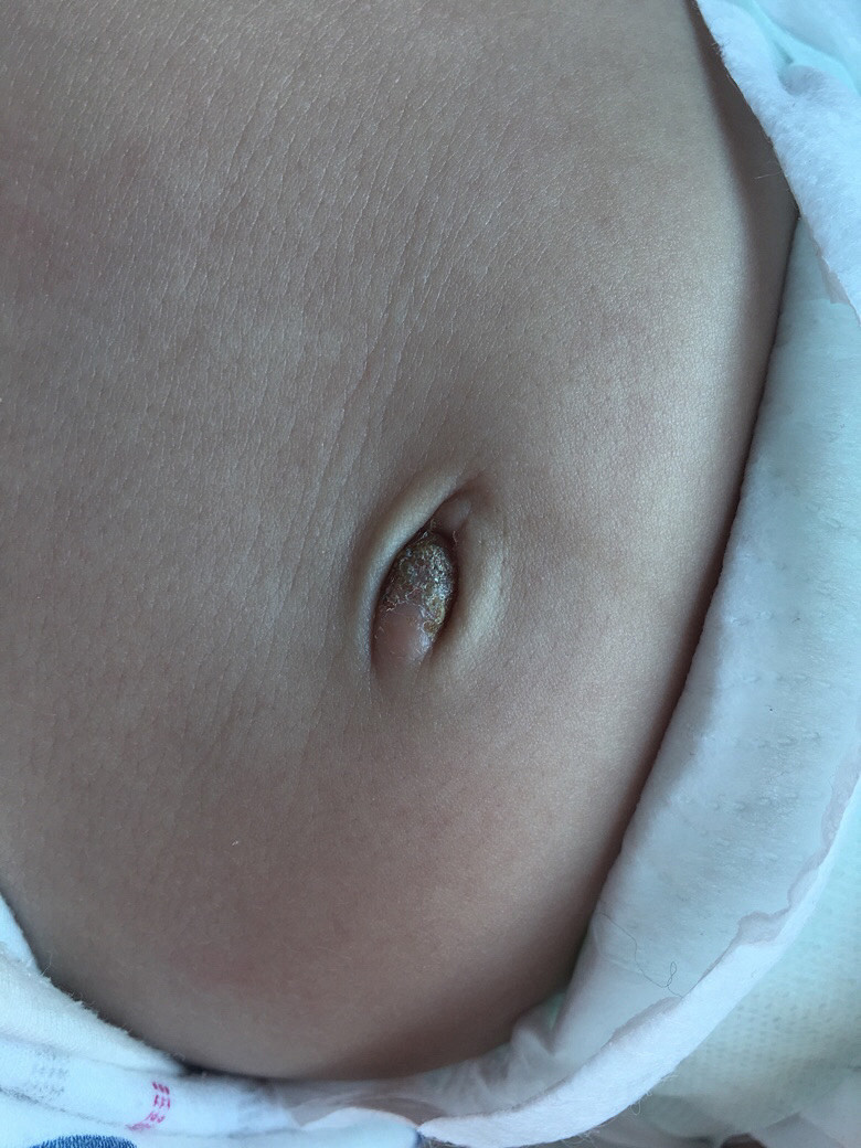 ��ҽ����һ���챦�����ڶ����۶�����������