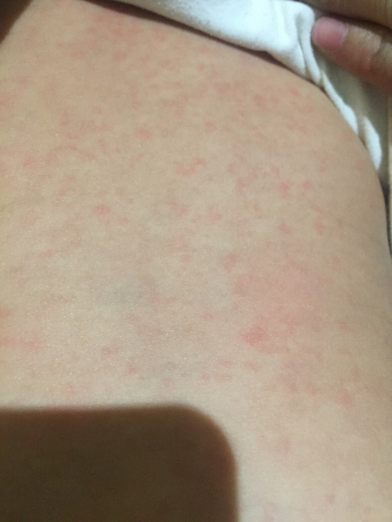 ��ҽ����ã�������11�����ˣ�ǰ�����һ