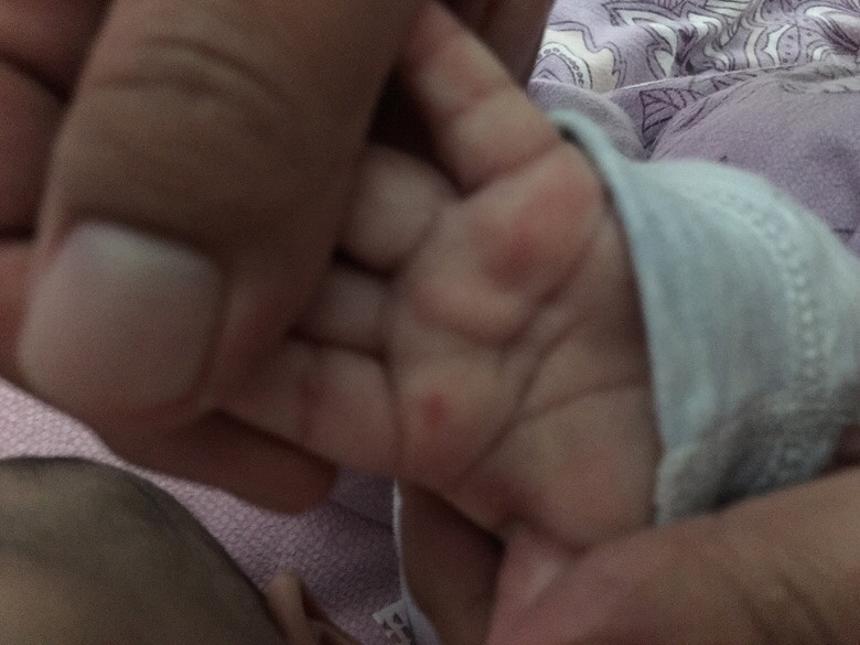 ��ҽ�������췢�ֱ���������������������