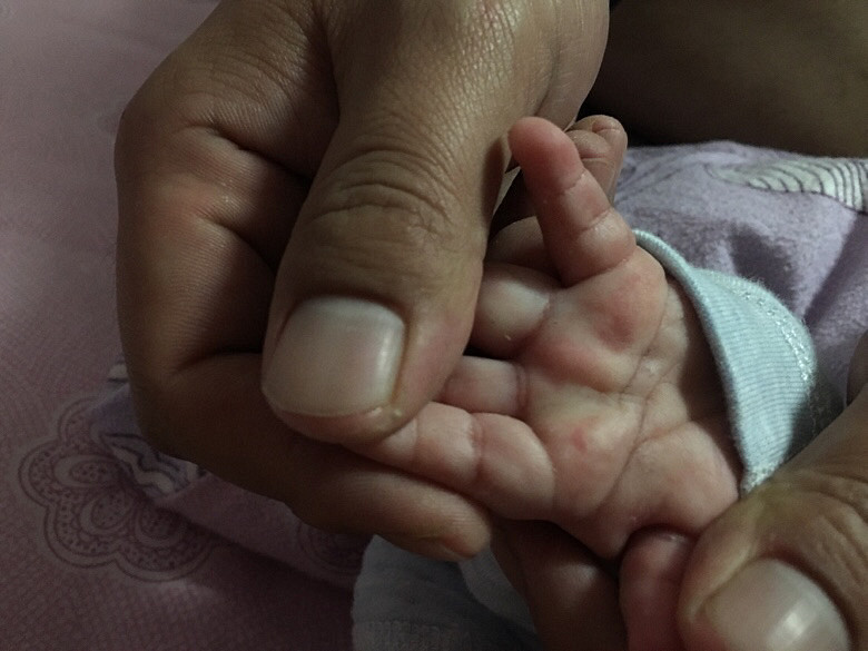 ��ҽ�������췢�ֱ���������������������