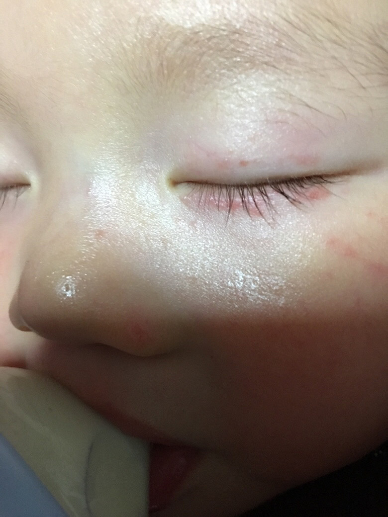 �����۾�������ʲô��