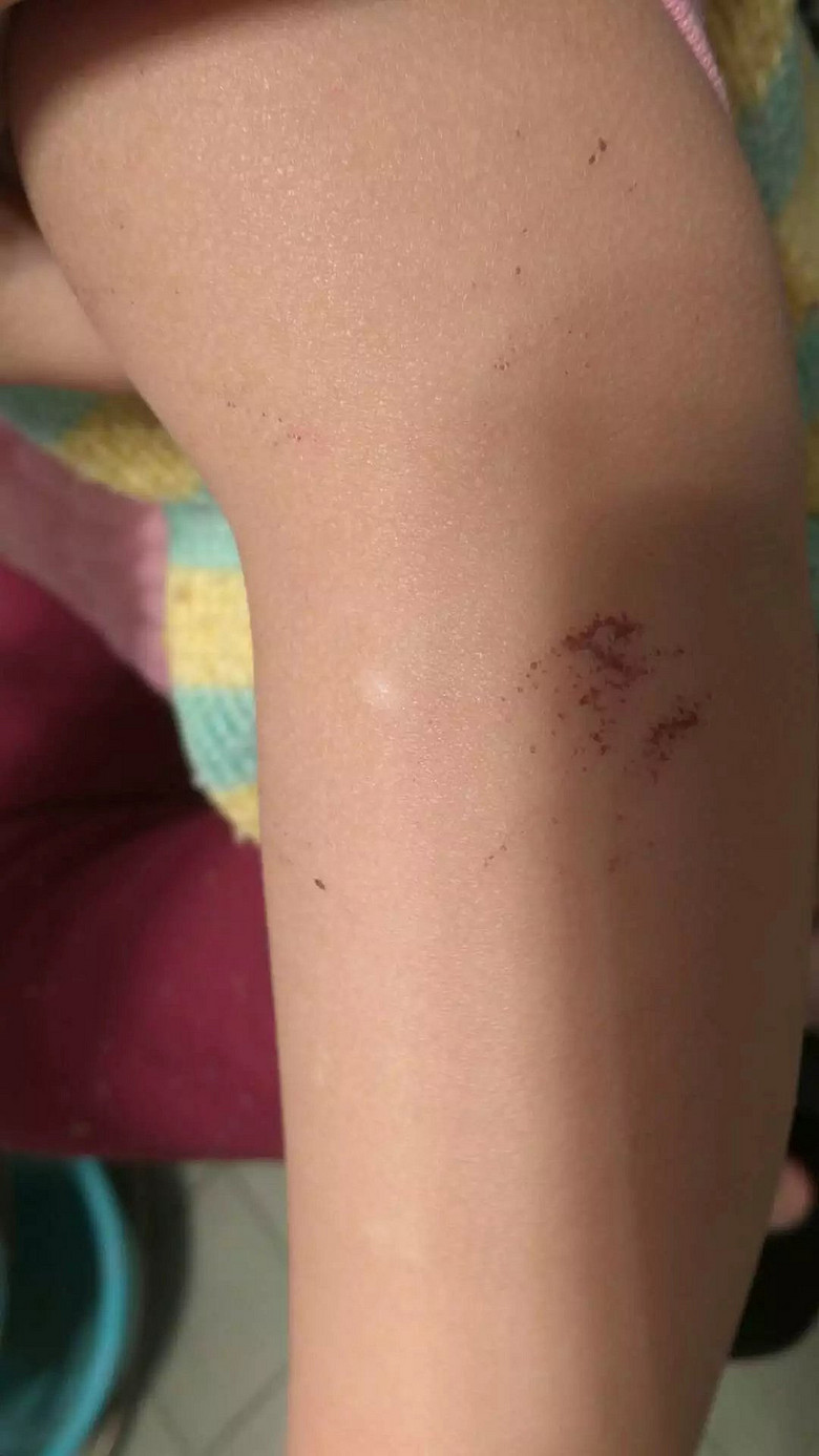 @��ҽ�� ������������ץ��Ѫ��