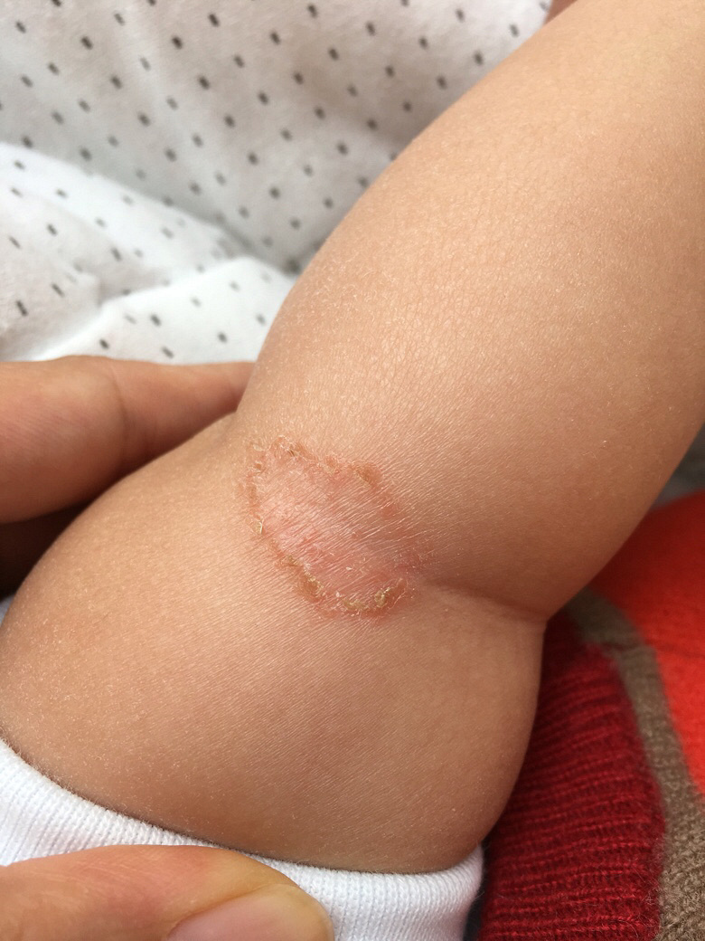 �����������£��ֱ۹ؽڴ�����һԪӲ�Ҵ�С�ĺ���