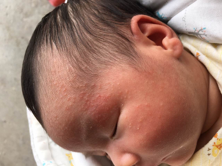 �������ϵ������ʪ�������