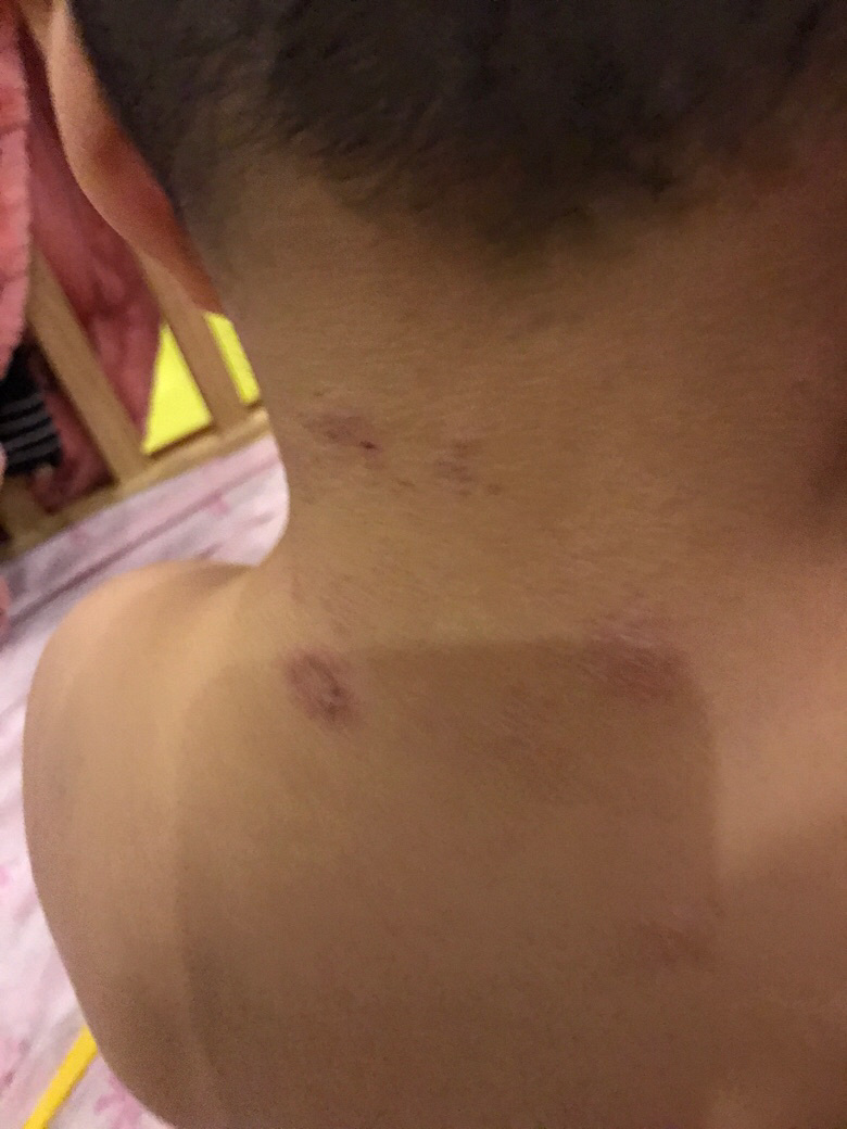 ��ҽ��������ʲô���Լ���������i���ü���