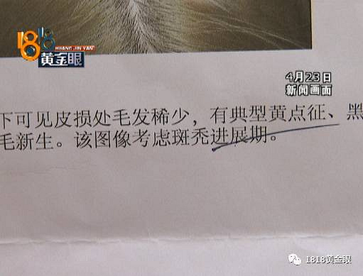 姑娘听听,造成女生?染发斑秃-v姑娘-南湖水背影专家樱花qq头像图片