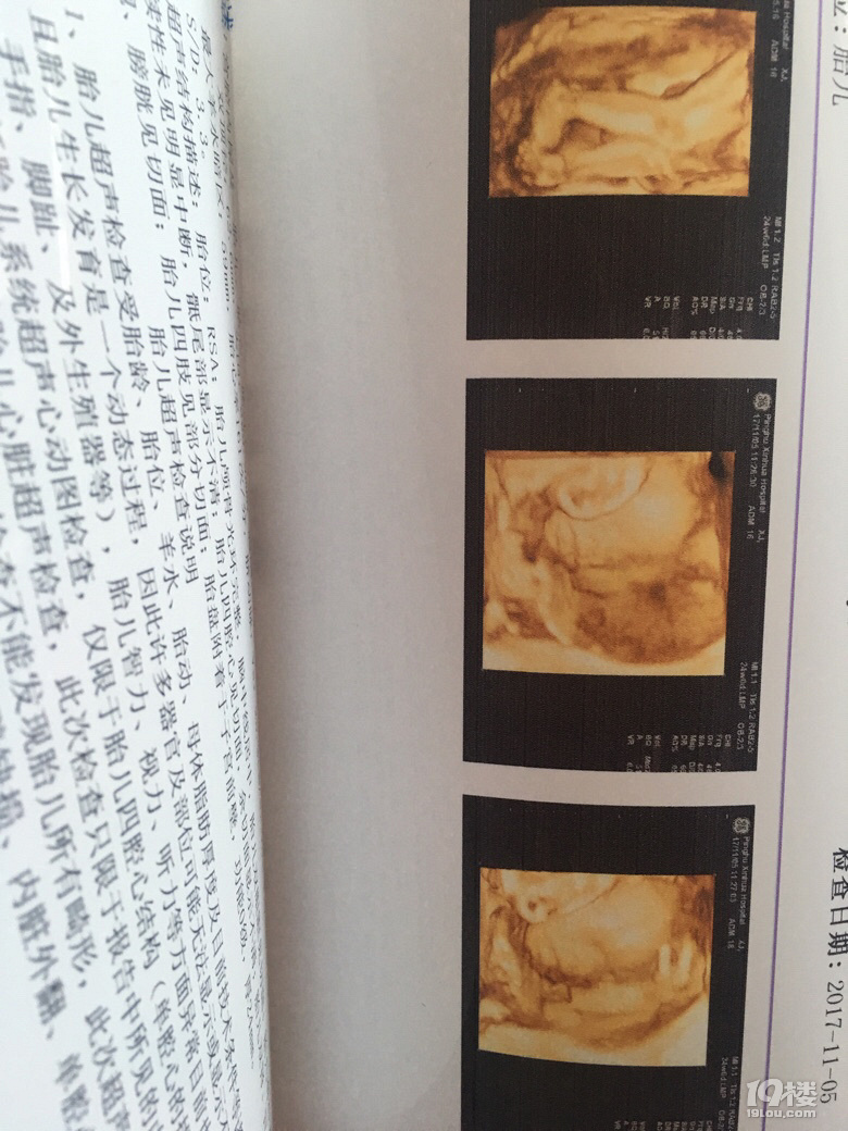 【悦程妇产杯·孕妈日记】+宝贝欢迎你