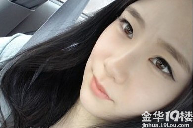 矫正下颌突出,术后我变成了山寨版的刘诗诗,求